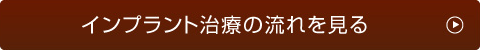 インプラント治療の流れを見る