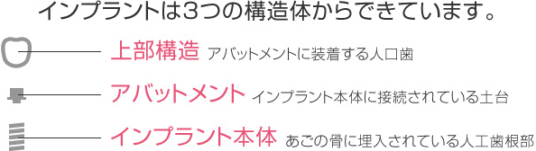 インプラントは3つの構造体からできています。